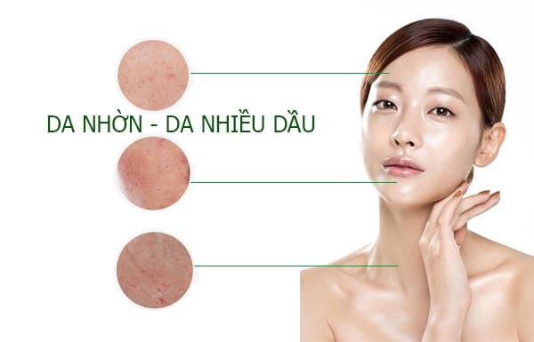 Da dầu là gì? Cách chăm sóc da dầu tránh khỏi mụn