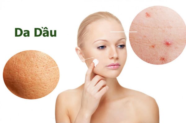 Chăm sóc da dầu đúng cách